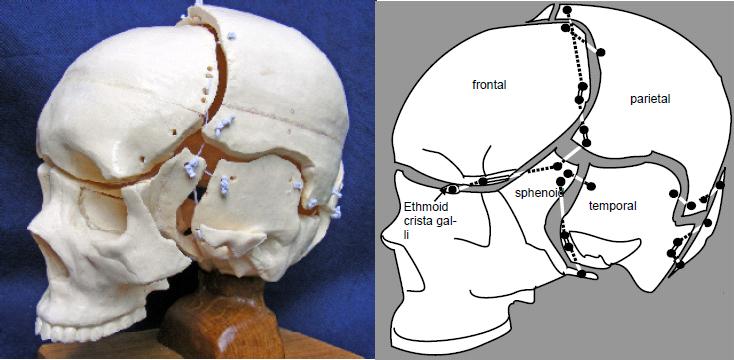 File:Cranial vault tensegrity model, antero-lateral view by Scarr.JPG