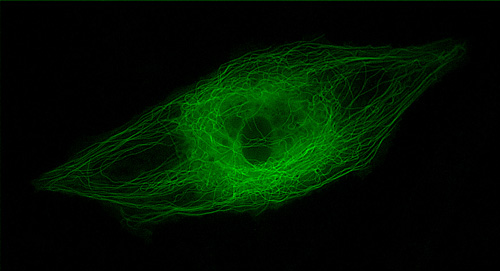 File:Microtubule filaments of the cytoskeleton of a cultured capillary endothelial by Ingber.jpg